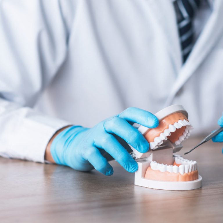 This is an image of a periodontist using a model of a mouth to explain a dental procedure.